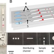 Imagen: Un dispositivo microfluídico basado en papel permite la detección de paludismo múltiple en sangre mediante la tecnología LAMP (Fotografía cortesía de la Universidad de Glasgow).