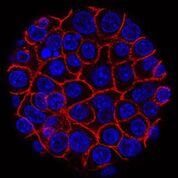 Imagen: Células de cáncer pancreático (azules) que crecen como una esfera encerrada en membranas (rojas) (Fotografía cortesía del Instituto Nacional del Cáncer de los Estados Unidos).