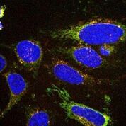 Imagen: La nueva tecnología de imagenología basada en sondas químicas fluorescentes permite la visualización de lo que las células comen, lo que podría ayudar al diagnóstico y tratamiento de enfermedades como el cáncer (Fotografía cortesía de la Universidad de Edimburgo).