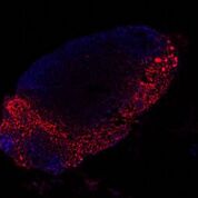 Imagen: La distribución de los exosomas derivados del melanoma (rojo) en los ganglios linfáticos del ratón (azul) (Fotografía cortesía del Centro Nacional de Investigaciones Oncológicas).