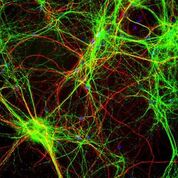 Imagen: Neurofilamentos (rojo) en células cerebrales cultivadas de rata (Fotografía cortesía de Wikimedia Commons).