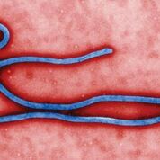 Imagen: Una imagen coloreada digitalmente, de microscopía electrónica de transmisión (TEM), que revela parte de la morfología ultraestructural mostrada por un virión del virus del Ébola (Fotografía cortesía de Cynthia Goldsmith/CDC).