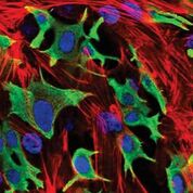 Imagen: Invasión de células de cáncer de mama a través de una capa de fibroblastos. Se ha encontrado que el cáncer de mama con receptores hormonales positivos se disemina más rápido cuando el microbioma se encuentra alterado (Fotografía cortesía de Institute of Cancer Research).