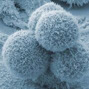 Imagen: Un estudio nuevo validó el uso de marcadores tumorales para seleccionar medicamentos de quimioterapia para pacientes con cáncer de páncreas metastásico (Fotografía cortesía de SPL).