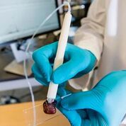 Imagen: El dispositivo de mano MasSpec Pen, que se puede conectar a un espectrómetro de masas para diagnosticar los cánceres de ovario y otros tipos de cáncer (Fotografía cortesía de la Universidad de Texas en Austin).