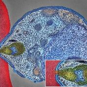 Imagen: Una micrografía electrónica coloreada que muestra el parásito de la malaria (derecha, azul) adherido a un glóbulo rojo humano. El recuadro muestra un detalle del punto de conexión con una mayor amplificación (Fotografía cortesía de [U.S.] NIAID a través de Wikimedia Commons).