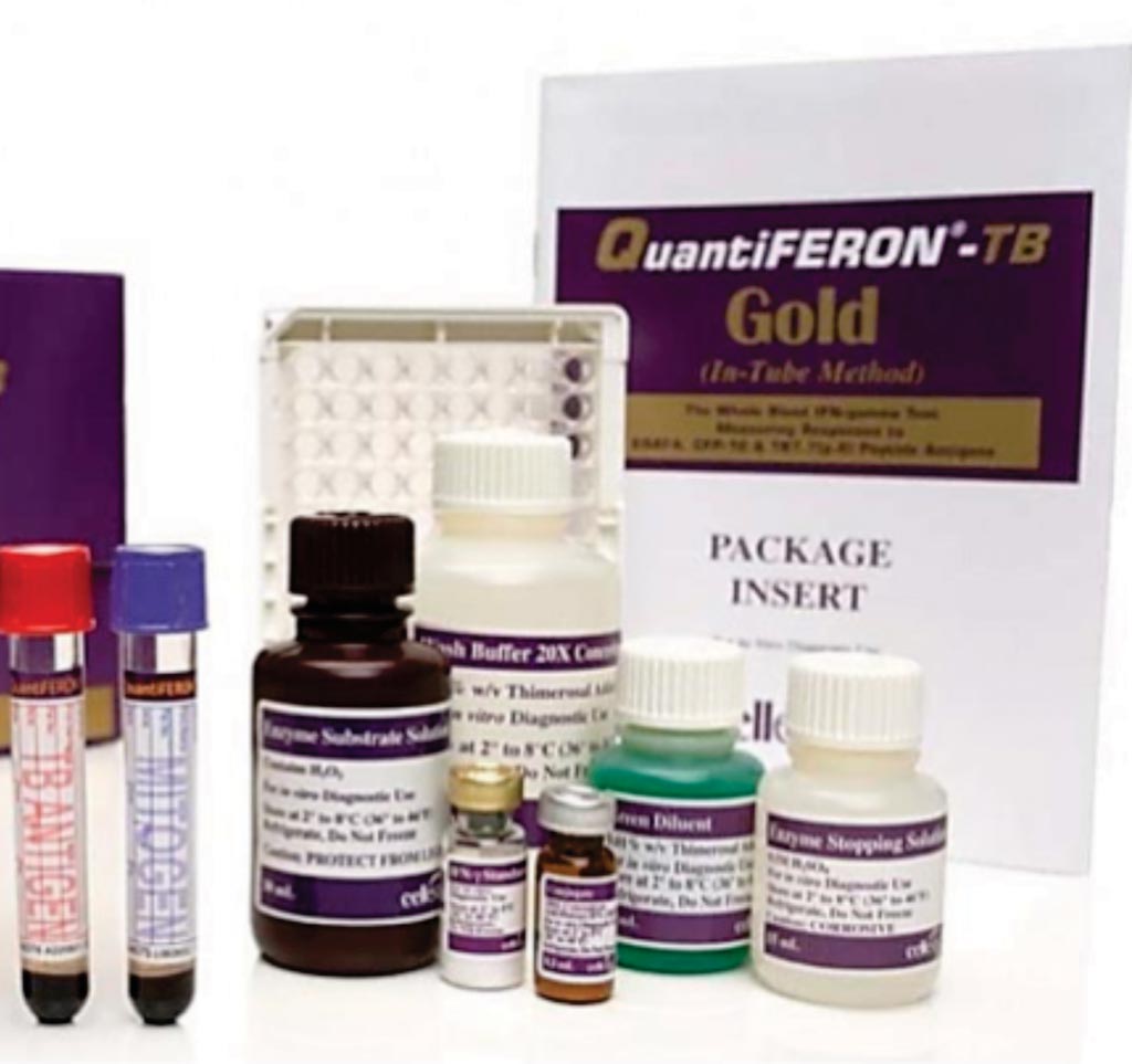 Imagen: La prueba QuantiFERON-TB Gold (QFT) es un análisis novedoso de sangre que mide la respuesta inmune mediada por las células de los individuos infectados con Mycobacterium tuberculosis (Fotografía cortesía de Qiagen).