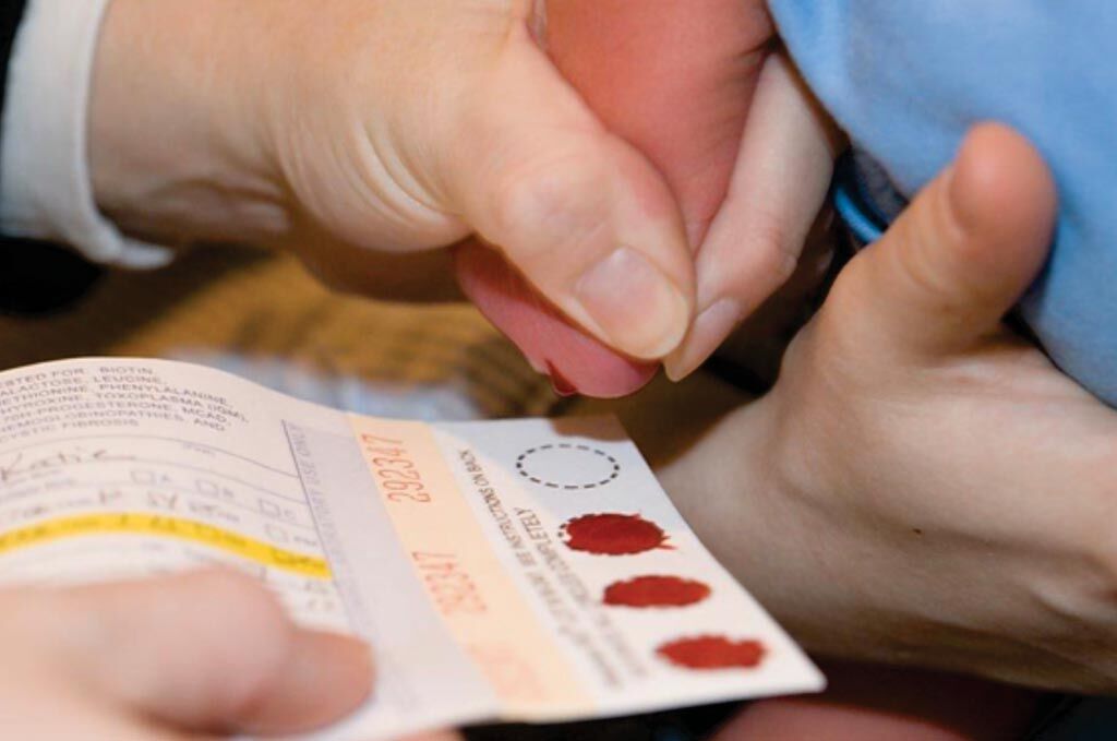 Imagen: Aplicación de la sangre de un recién nacido a una tarjeta Guthrie para analizar varias enfermedades, incluido el citomegalovirus (Fotografía cortesía del NHS).