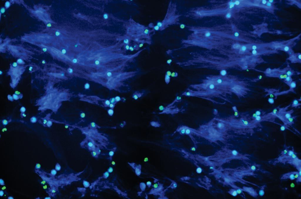 Imagen: Kit de ensayo NETosis: los PMA inducen la formación de una trampa extracelular de neutrófilos (NET) en los neutrófilos humanos (Fotografía cortesía de Cayman Chemical).