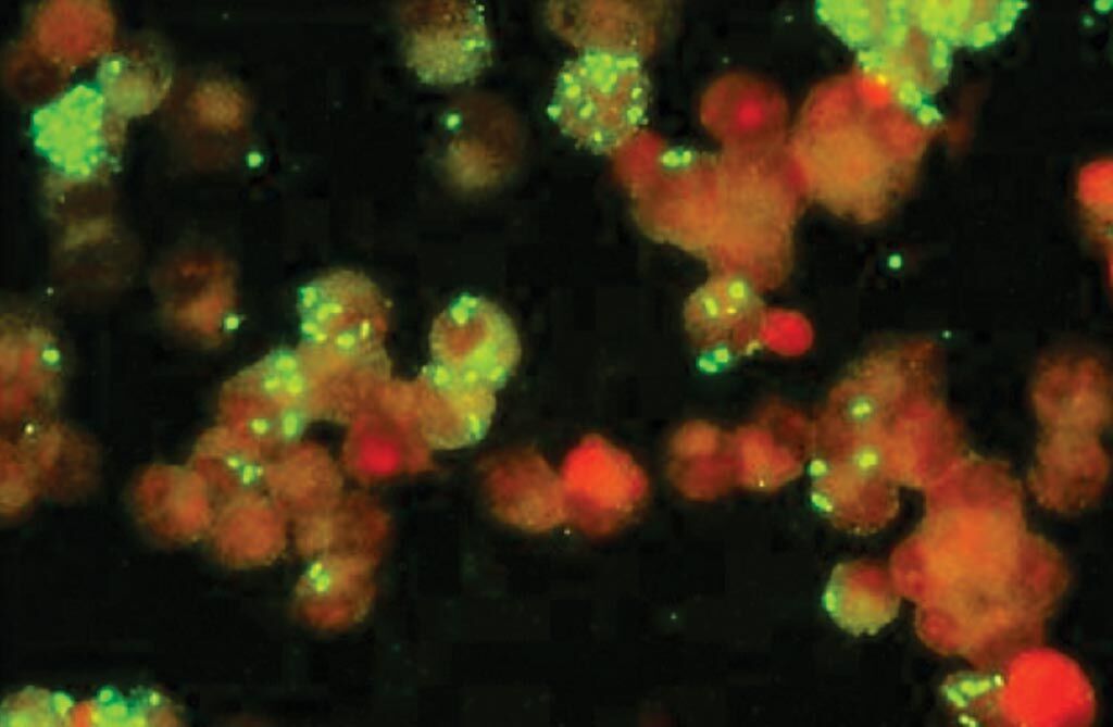 Imagen: Una fotomicrografía de un ensayo de inmunofluorescencia (IFA) para Rickettsia (Fotografía cortesía de Fuller Laboratories).
