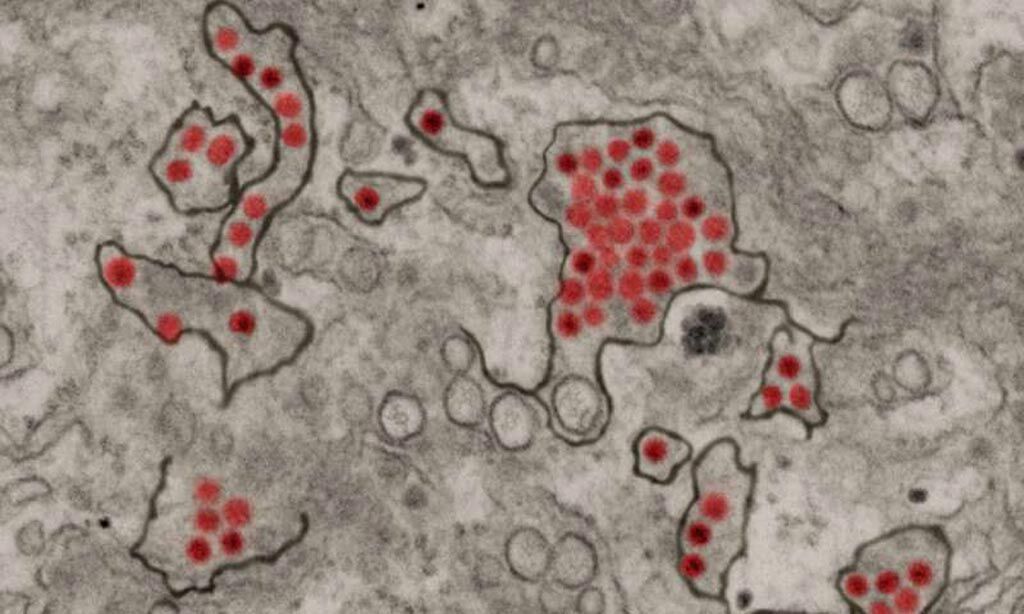 Imagen: Partículas del virus del Zika (rojo) en las células renales del mono verde africano (Fotografía cortesía del Instituto Nacional de Alergias y Enfermedades Infecciosas [EUA]).