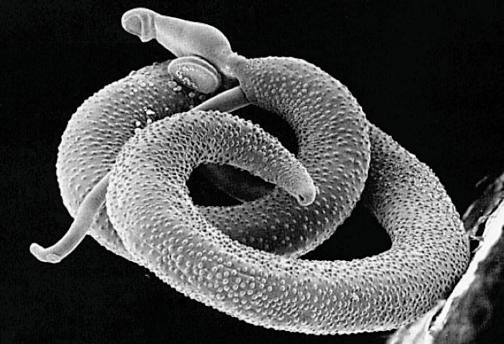 Imagen: Microfotografía electrónica de barrido de un par de Schistosoma mansoni (Fotografía cortesía del Laboratorio Davies de la Universidad de Servicios Uniformados).