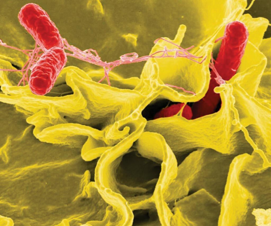 Imagen: Microfotografía electrónica de barrido realzada con color mostrando células humanas cultivadas invadidas por Salmonella typhimurium (rojo) (Fotografía cortesía del Instituto Nacional de Alergias y Enfermedades Infecciosas de los EUA).