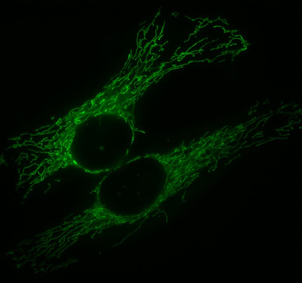 Imagen: Una red mitocondrial típica (verde) en dos células humanas (Fotografía cortesía de Wikimedia Commons).