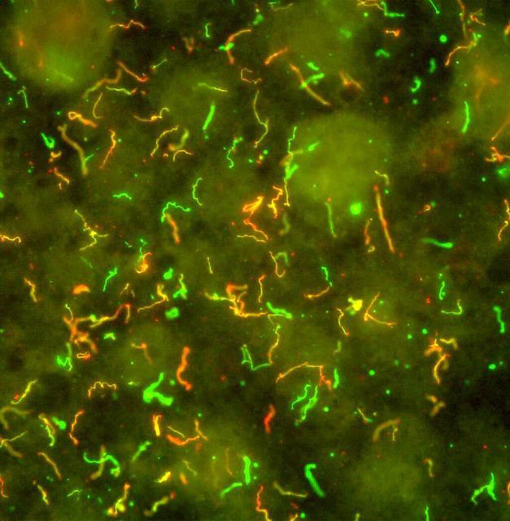 Imagen: En esta fotomicrografía, la bacteria en forma de espiral que causa la enfermedad de Lyme, Borrelia burgdorferi, se ve iluminada con anticuerpos fluorescentes rojos y verdes (Fotografía cortesía del Instituto Nacional de Alergias y Enfermedades Infecciosas).