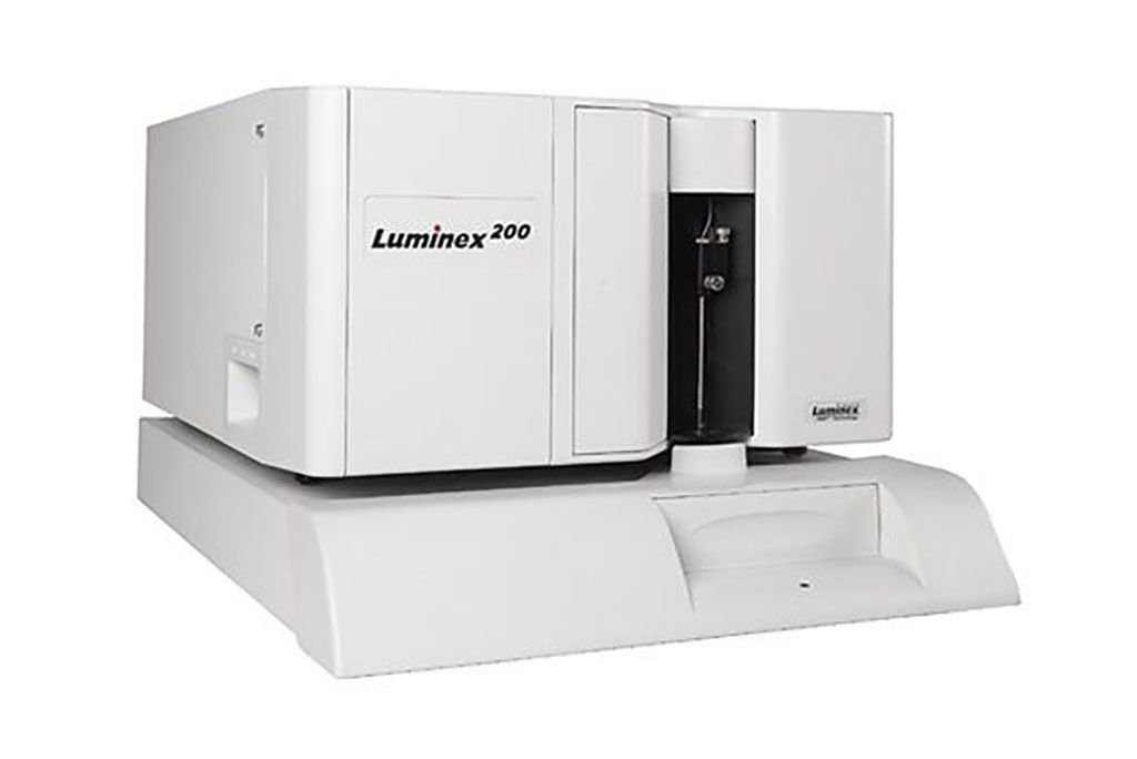 Imagen: El sistema Luminex 100/200 es un instrumento de diagnóstico clínico que permite la multiplexación de hasta 100 analitos en un solo pozo de una placa de microtitulación (Fotografía cortesía de Luminex Corporation)