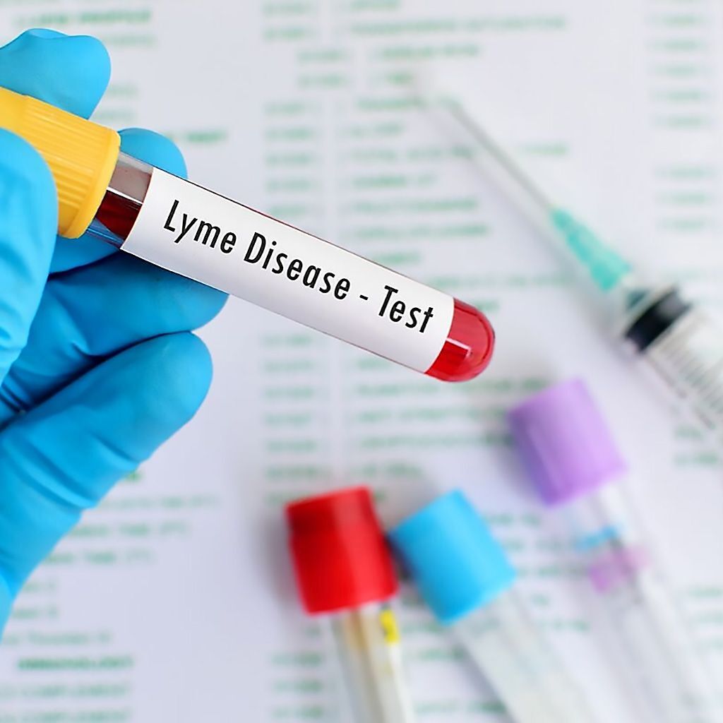 Imagen: Se ha evaluado el desempeño diagnóstico del inmunoensayo enzimático C6 para la artritis de Lyme (Fotografía cortesía de Lonnie R. Marcum, PT, BSHCA)