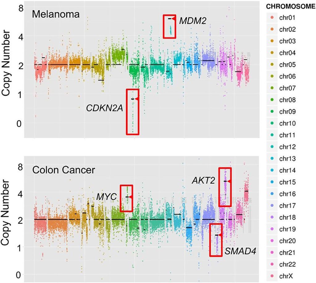 Imagen: Detección de las variantes en el número de copia (VNC) directamente por secuenciación UW-OncoPlex. Se exponen ejemplos de una muestra de melanoma y de cáncer de colon (Fotografía cortesía de Noah G. Hoffman, MD, PhD).