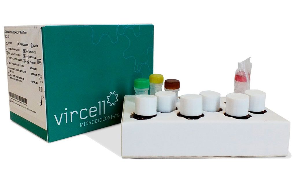 Imagen: El kit de detección Vircell COVID-19 (Fotografía cortesía de Vircell)