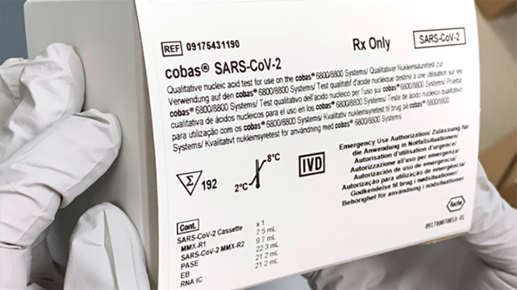 Imagen: Prueba cobas SARS-Cov-2 (Fotografía cortesía de Roche Holdings AG)