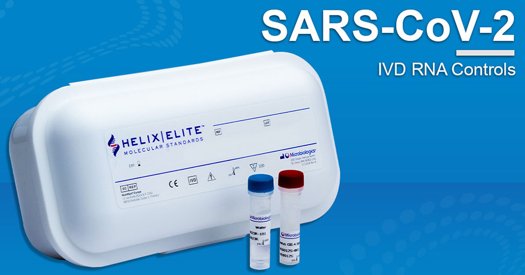 Imagen: Control IVD de ARN para pruebas de SARS-CoV-2 de Microbiologics (Fotografía cortesía de Microbiologics, Inc.)