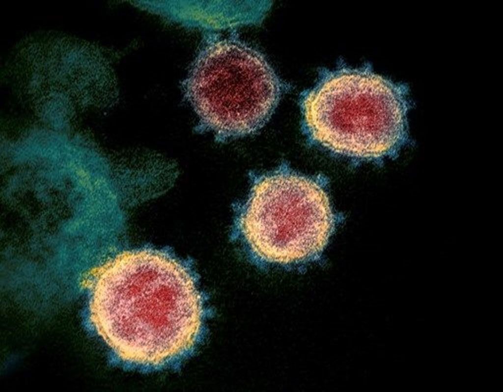 Imagen: Esta imagen de un microscopio electrónico de transmisión muestra el SARS-CoV-2, el virus que causa la COVID-19, aislado de un paciente en los Estados Unidos (Fotografía cortesía del Instituto Nacional de Alergias y Enfermedades Infecciosas [EUA])