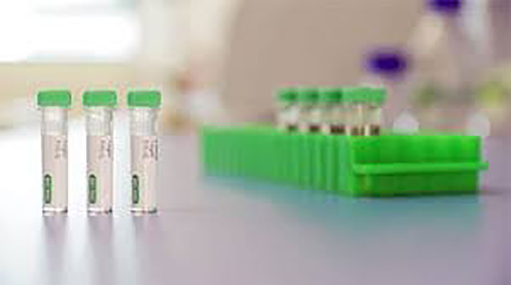 Imagen: Bio-Rad lanza análisis serológico para la detección de anticuerpos contra el coronavirus (Fotografía cortesía de Bio-Rad Laboratories, Inc.)