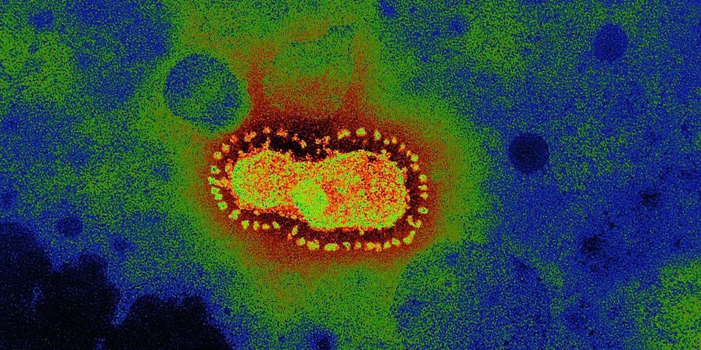 Imagen: Microscopía electrónica de transmisión en color del coronavirus. Se encontró que el esputo y las heces dieron resultados positivos para SARS-CoV-2 después de la conversión de las muestras faríngeas en los pacientes con COVID-19. Este virus se aisló de la materia fecal de un paciente con diarrea (Fotografía cortesía de BSIP/UIG)