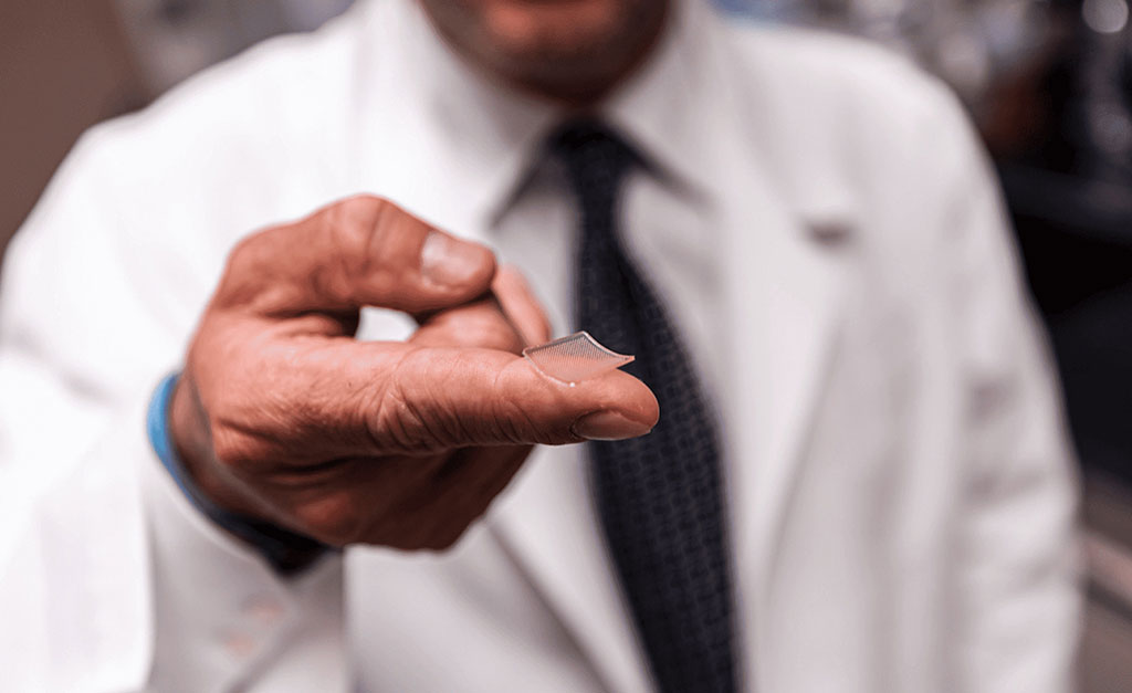 Imagen: Vacuna de matriz de microagujas  (Fotografía cortesía de Facultad de Medicina de la Universidad de Pittsburgh)