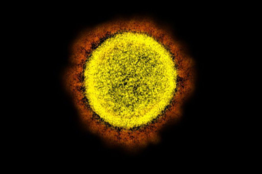 Imagen: Micrografía electrónica de transmisión del virus SARS-CoV-2 (Fotografía cortesía del NIAID)