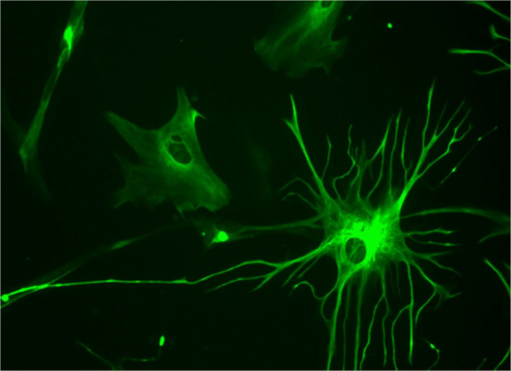 Imagen: Microfotografía que muestra un astrocito humano que crece en cultivo cerebral. Una elevación en los marcadores de proteínas de los astrocitos se asoció con un estado antiinflamatorio en los cerebros de pacientes con enfermedad de Alzheimer (Fotografía cortesía de Wikimedia Commons)