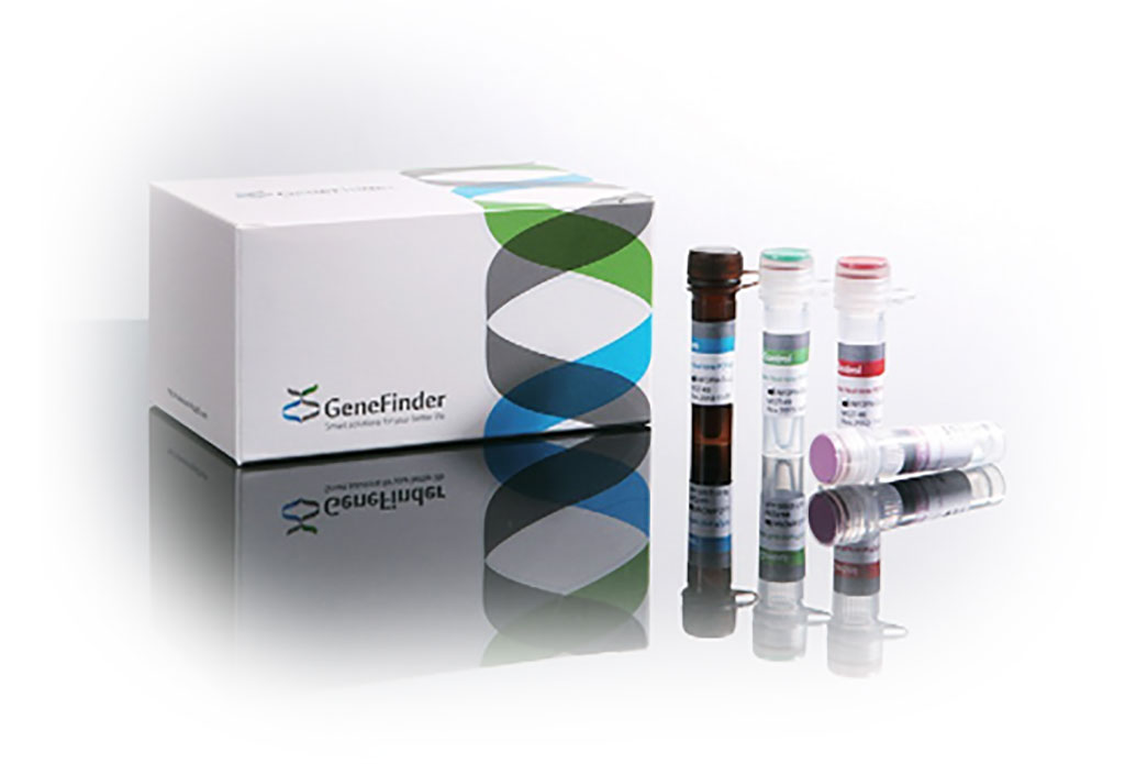 Imagen: El Kit GeneFinder ™ COVID-19 PLUS RealAmp (Fotografía cortesía del Grupo ELITech MDx LLC)