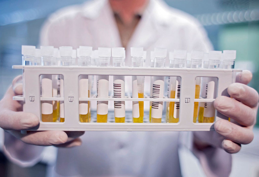 IlustraciónEstá en curso un ensayo en los Institutos Feinstein de Investigación Médica (Manhasset, NY, EUA) para la famotidina, el compuesto activo del medicamento de venta libre para la acidez estomacal Pepcid, con el fin de estudiar si el medicamento puede marcar la diferencia en el tratamiento de los pacientes con COVID-19.