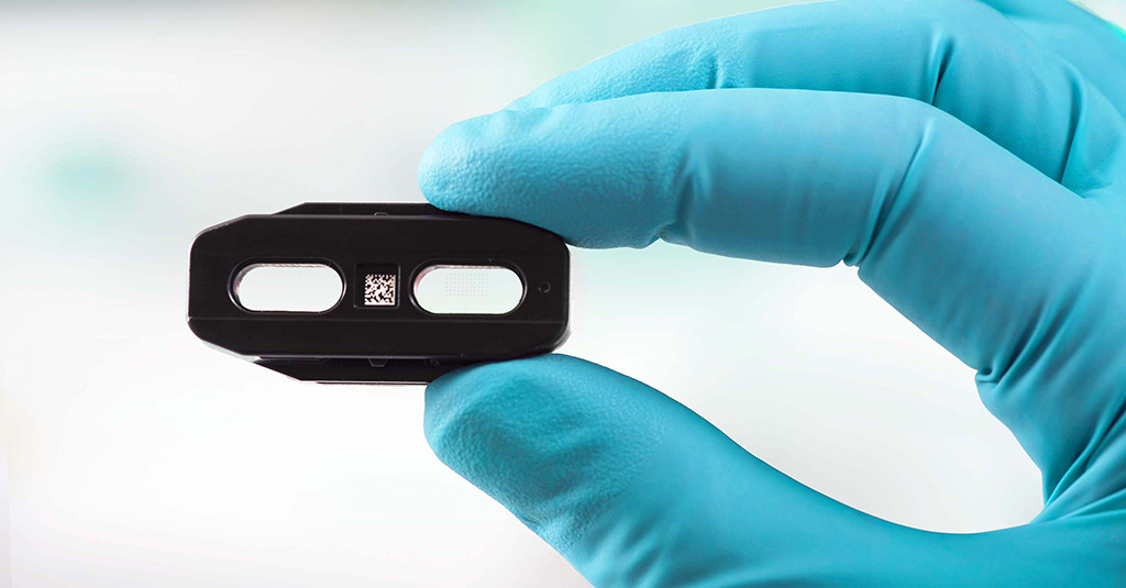 Imagen: Microarray de anticuerpos MosaiQ COVID-19 (Fotografía cortesía de Quotient Limited)