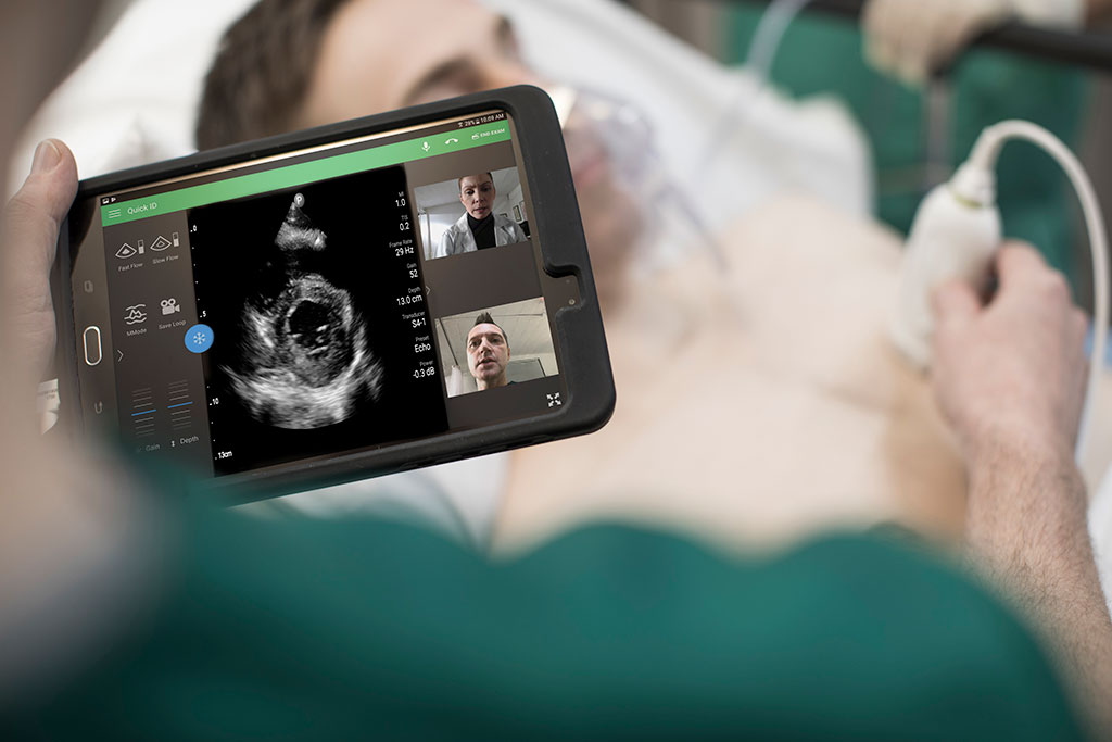 Imagen: Philips recibe la aprobación para uso del portafolio de ultrasonido para manejar complicaciones por COVID-19 (fotografía cortesía de Philips Healthcare)