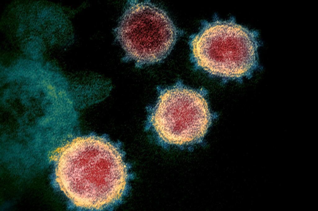 Imagen: Imagen del microscopio electrónico de transmisión que muestra el SARS-CoV-2, el virus que causa la COVID-19 (Fotografía cortesía del Instituto Nacional de Alergias y Enfermedades Infecciosas [EUA])