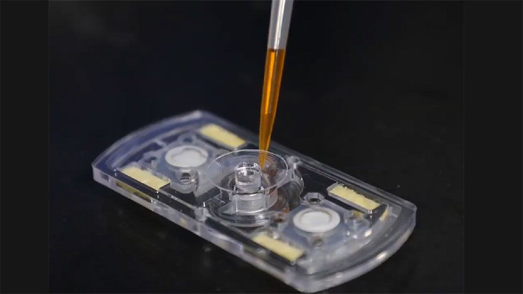 Imagen: Un fidget spinner para el diagnóstico de infecciones urinarias en los puntos de atención (Fotografía cortesía del Instituto Nacional de Ciencia y Tecnología de Ulsan).