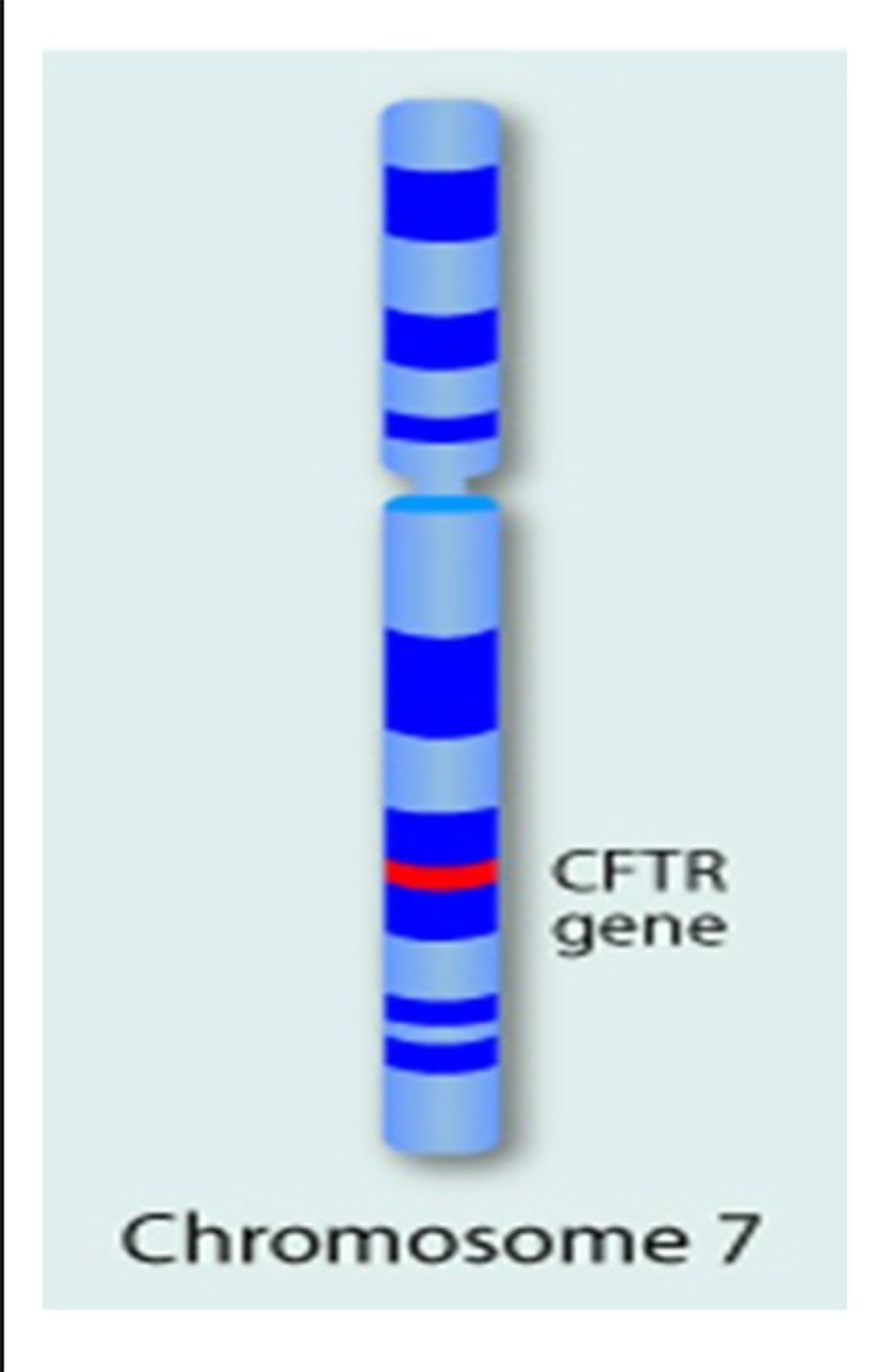 Imagen: El gen único, el gen regulador de la transmembrana de la fibrosis quística (CFTR) se encuentra en el brazo largo del cromosoma 7, y sus mutaciones causan la FQ (Fotografía cortesía de Daryl Isaac).