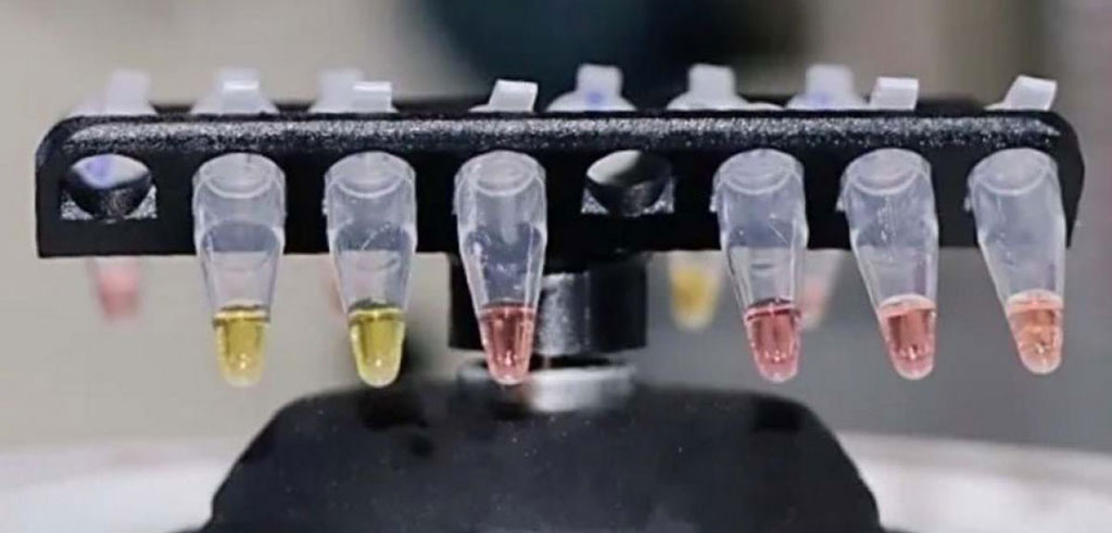 Imagen: La prueba rápida para la COVID-19 de la Universidad de Oxford detecta el SARS-CoV-2 en 30-45 minutos (Fotografía cortesía de la Universidad de Oxford)