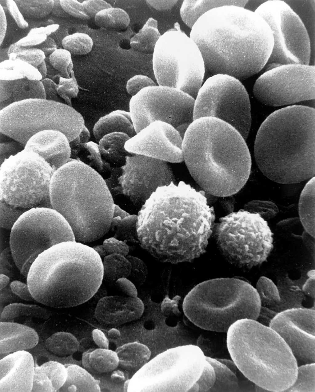 Imagen: Una imagen de microscopio electrónico de barrido de sangre humana normal en circulación, que muestra glóbulos rojos, varios tipos de glóbulos blancos, incluidos linfocitos, monocitos, neutrófilos y muchas plaquetas pequeñas en forma de disco (Fotografía cortesía del Instituto Nacional del Cáncer [EUA])