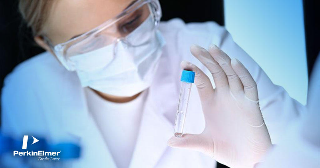 Imagen: PerkinElmer lanza paneles de datos, en línea, de acceso abierto, COVID-19 para acelerar el descubrimiento de antivirales y vacunas (Fotografía cortesía de PerkinElmer, Inc.)