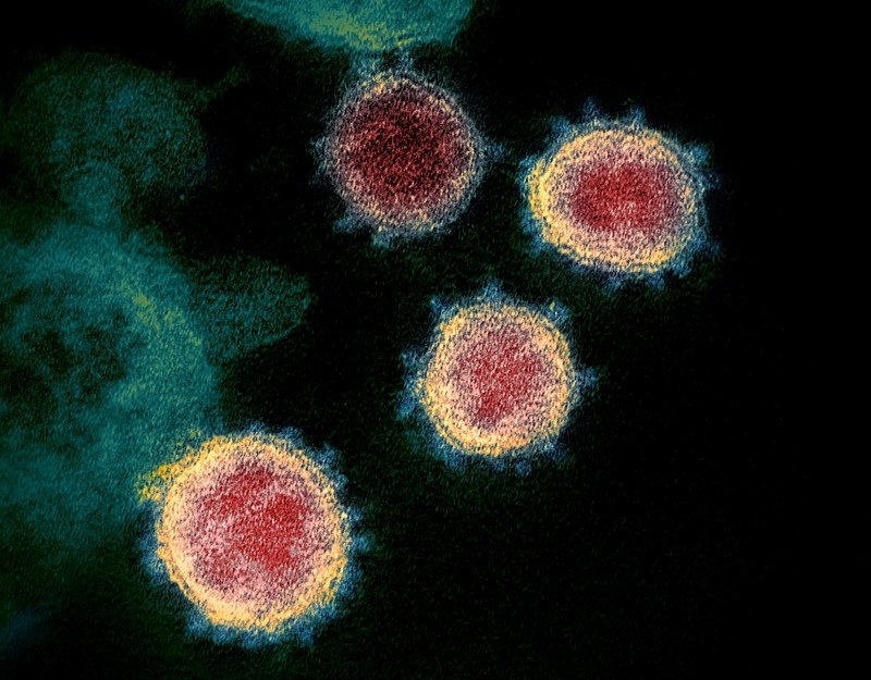 Imagen: Imagen de microscopio electrónico de transmisión, del SARS-CoV-2 (2019-nCoV), el virus que causa la COVID-19, aislado de un paciente en los EUA. Se muestran partículas de virus emergiendo de la superficie de células cultivadas en el laboratorio. (Imagen cortesía del Instituto Nacional de Alergias y Enfermedades Infecciosas a través de Wikimedia Commons)