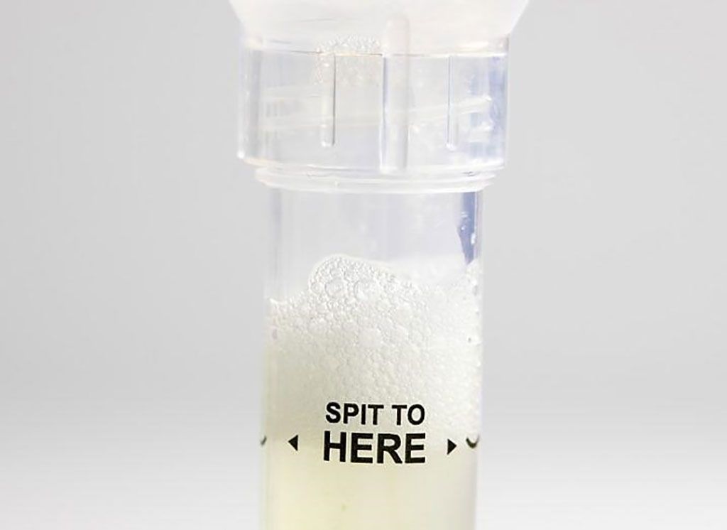 Imagen: Un tubo de ensayo contiene saliva que se puede analizar para el biomarcador de ataque cardíaco, troponina cardíaca (Fotografía cortesía de karenfoleyphoto).