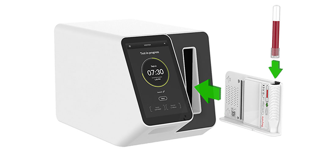 Imagen: El diagnóstico rápido basado en aprendizaje automático lee el sistema inmunológico para predecir el riesgo de severidad de la COVID-19 (Fotografía cortesía de Inflammatix)