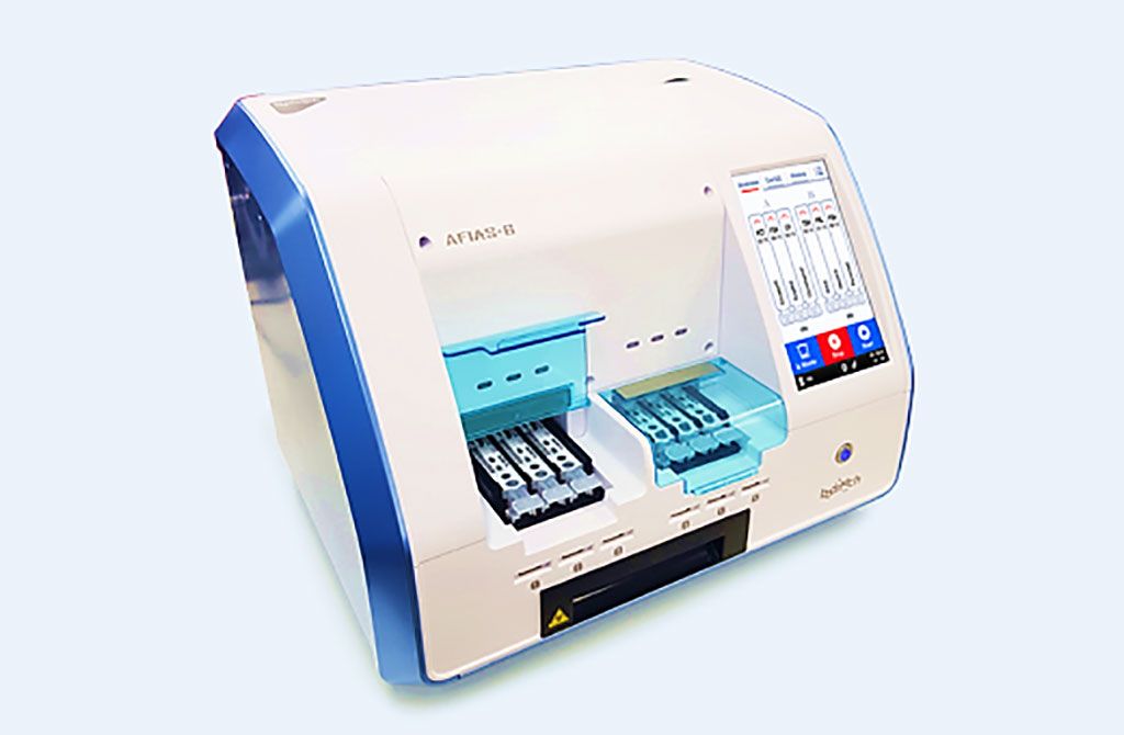 Imagen: El AFIAS-6 (sistema de inmunoensayo fluorescente automatizado-AFIAS) es un sistema de inmunoensayo fluorescente automatizado que utiliza sangre, orina y otro tipo de muestras para medir cuantitativa o semicuantitativamente la concentración del analito objetivo (Fotografía cortesía de Boditech Med Inc).