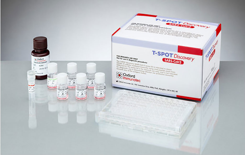 Imagen: Ensayo T-SPOT Discovery SARS-CoV-2 (Fotografía cortesía de Oxford Immunotec)