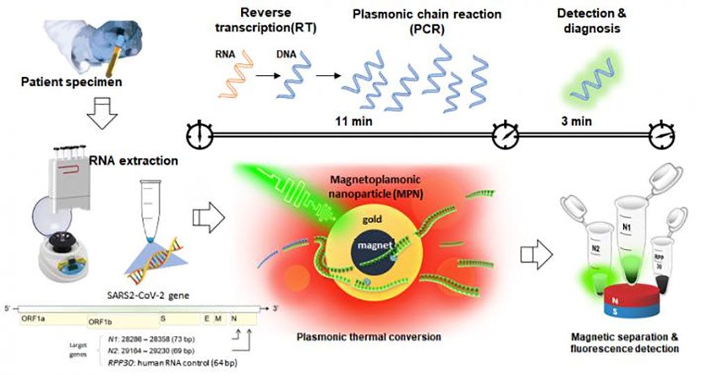 Imagen: El ARN del coronavirus se extrajo de la muestra del paciente, luego se sometió a transcripción inversa, amplificación de genes y detección a través de nanoPCR, para diagnosticar la infección por COVID-19. Para la rápida amplificación y detección de genes, se utilizaron nanopartículas magneto-plasmónicas (MPN) para facilitar el ciclo de cambio de temperatura de la RT-PCR existente a alta velocidad. Finalmente, un campo magnético separó las MPN y se detectó la señal fluorescente del ADN amplificado (Fotografía cortesía del Instituto de Ciencias Básicas, Corea)