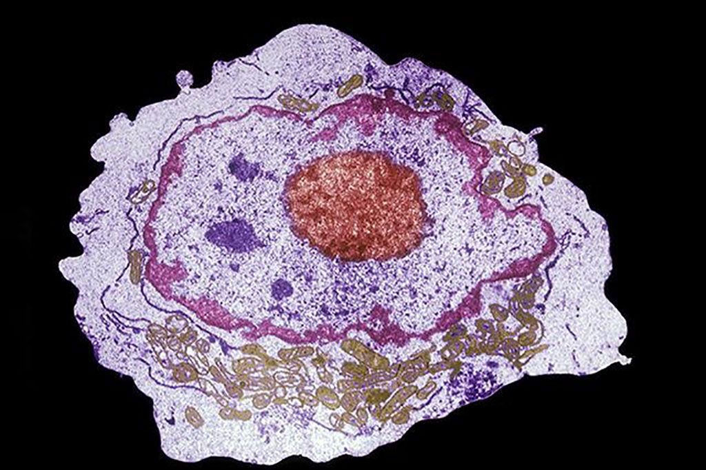 Imagen: Microfotografía electrónica de una célula madre hematopoyética que se puede obtener de sangre del cordón umbilical, médula ósea adulta y sangre periférica (Fotografía cortesía de Donald W. Fawcett, MD).