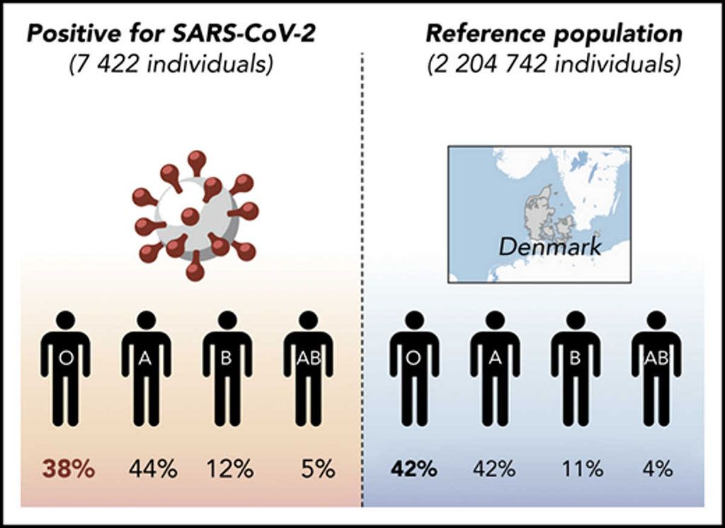 Imagen: Reportan en Dinamarca que los individuos del grupo sanguíneo O tienen una prevalencia menor de infección por SARS-CoV-2 (Fotografía cortesía del Hospital Universitario de Odense).