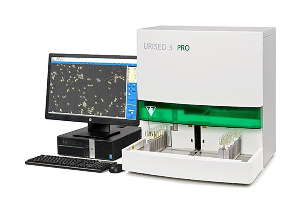 Imagen: El UriSed 3 PRO es un analizador profesional, automatizado, de sedimentos de orina con un nuevo y revolucionario sistema óptico que combina la microscopía de contraste de fase y de campo claro (Fotografía cortesía de 77 Elektronika)